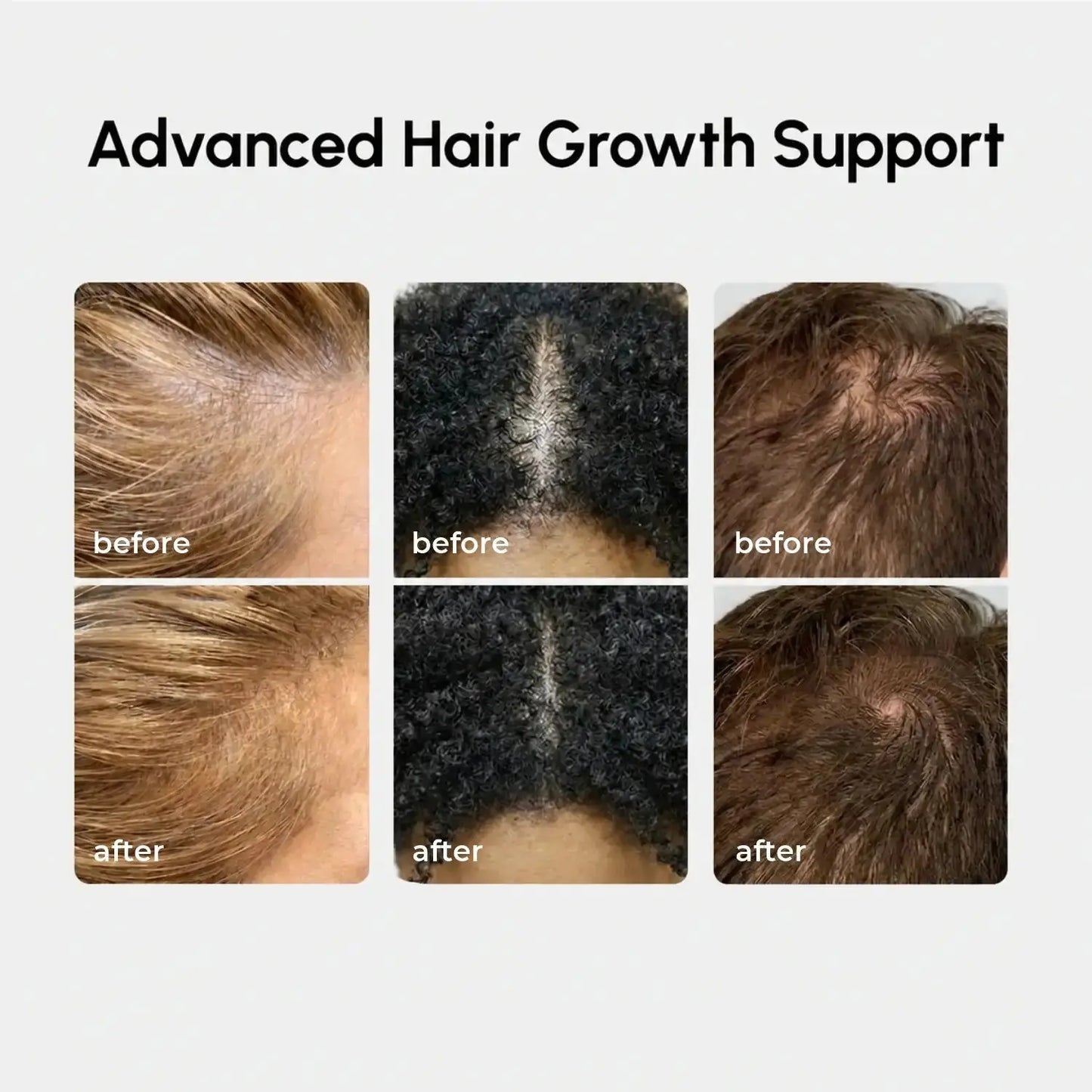 4-in-1 Hair Growth Spray Maree