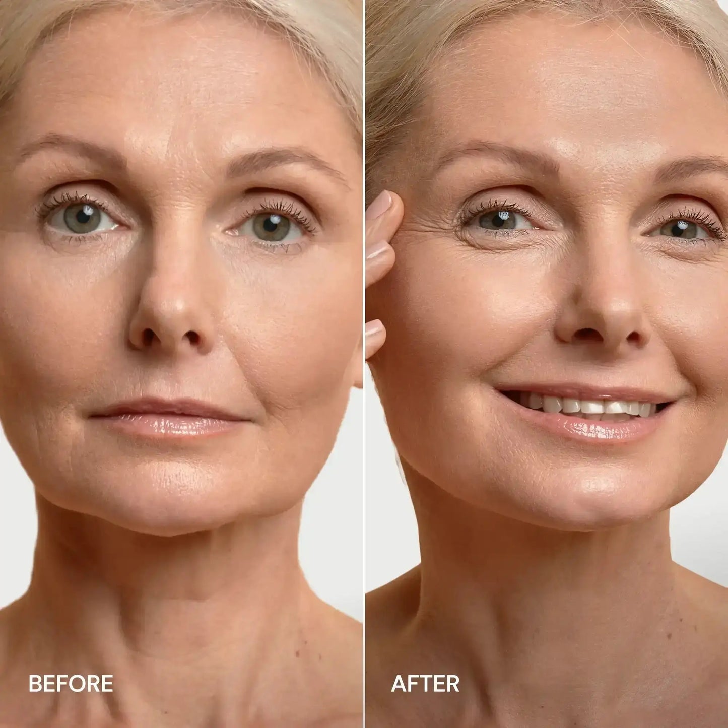 24K Gold V-Line Lifting Mask Maree