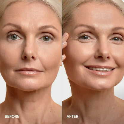 24K Gold V-Line Lifting Mask Maree
